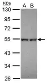 Anti-DPF1 antibody used in Western Blot (WB). GTX119318