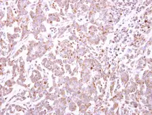 Anti-TRIM49 antibody [N1C1] used in IHC (Paraffin sections) (IHC-P). GTX119323