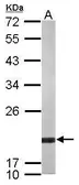 Anti-ARF5 antibody used in Western Blot (WB). GTX119329