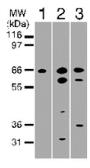 Anti-DR6 antibody used in Western Blot (WB). GTX11933