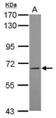 Anti-LILRB3 antibody [N1C1] used in Western Blot (WB). GTX119342