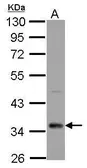 Anti-CPXCR1 antibody used in Western Blot (WB). GTX119353