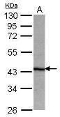 Anti-C14orf169 / NO66 antibody [C2C3], C-term used in Western Blot (WB). GTX119355