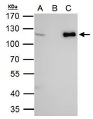 Anti-CHD1L antibody [N2C1], Internal used in Immunoprecipitation (IP). GTX119360
