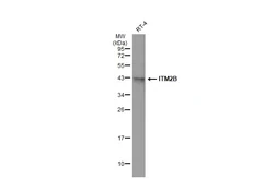 Anti-ITM2B antibody used in Western Blot (WB). GTX119361