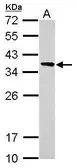 Anti-Calponin 2 antibody used in Western Blot (WB). GTX119368