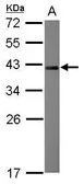 Anti-NRBF2 antibody [N1C2] used in Western Blot (WB). GTX119371