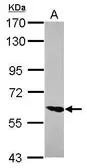 Anti-ZNF76 antibody used in Western Blot (WB). GTX119376