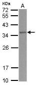 Anti-TRMT61A antibody [N1C2] used in Western Blot (WB). GTX119398