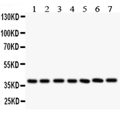 Anti-LIF antibody used in Western Blot (WB). GTX11940