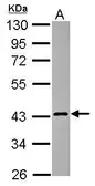Anti-Calreticulin 3 antibody [N1C1] used in Western Blot (WB). GTX119406