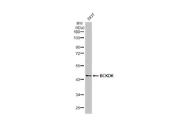 Anti-BCKDK antibody [N1C2] used in Western Blot (WB). GTX119413