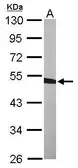 Anti-BCKDK antibody [N1C2] used in Western Blot (WB). GTX119413