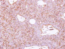 Anti-SIGLEC12 antibody [N2C2], Internal used in IHC (Paraffin sections) (IHC-P). GTX119418