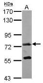 Anti-GALNT7 antibody [C1C3] used in Western Blot (WB). GTX119421