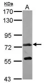 Anti-GALNT7 antibody [C1C3] used in Western Blot (WB). GTX119421