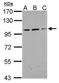 Anti-TRAK2 antibody [N1N2], N-term used in Western Blot (WB). GTX119423