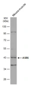 Anti-ASB5 antibody used in Western Blot (WB). GTX119425
