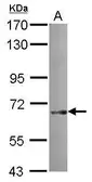 Anti-SNX18 antibody used in Western Blot (WB). GTX119426
