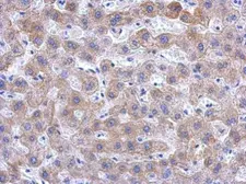 Anti-KIR2DS2 antibody used in IHC (Paraffin sections) (IHC-P). GTX119433
