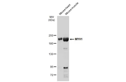 Anti-MYH1 antibody [N1], N-term used in Western Blot (WB). GTX119435