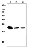 Anti-TREM1 antibody used in Western Blot (WB). GTX11944