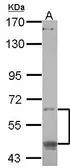 Anti-CREB3L1 antibody [N1C1] used in Western Blot (WB). GTX119442
