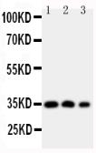 Anti-HOXA4 antibody used in Western Blot (WB). GTX11946