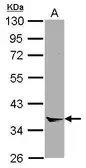 Anti-Annexin VIII antibody [N1C2] used in Western Blot (WB). GTX119470