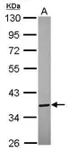Anti-Annexin VIII antibody [N2C3] used in Western Blot (WB). GTX119471