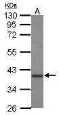Anti-Creatine kinase MT antibody [C1C3] used in Western Blot (WB). GTX119474