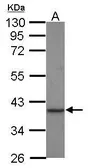 Anti-Creatine kinase MT antibody [C1C3] used in Western Blot (WB). GTX119474