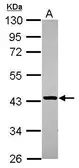 Anti-STBD1 antibody [N1C3] used in Western Blot (WB). GTX119493