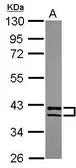 Anti-PDLIM2 antibody [N1C3] used in Western Blot (WB). GTX119496