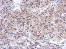 Anti-Spinesin antibody [N3C3] used in IHC (Paraffin sections) (IHC-P). GTX119497