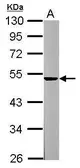 Anti-Spinesin antibody [N3C3] used in Western Blot (WB). GTX119497