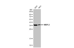 Anti-MRPL3 antibody [N3C3] used in Western Blot (WB). GTX119503