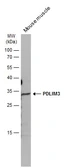 Anti-ALP / PDLIM3 antibody used in Western Blot (WB). GTX119505