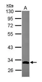 Anti-GIMAP5 antibody [N2C3] used in Western Blot (WB). GTX119506