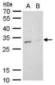 Anti-TPPP antibody [N1C3] used in Western Blot (WB). GTX119520