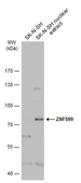 Anti-ZNF599 antibody used in Western Blot (WB). GTX119526
