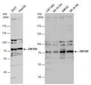 Anti-ZNF256 antibody [N1N3] used in Western Blot (WB). GTX119533