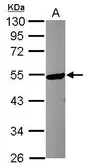 Anti-KATNA1 antibody [N2C2], Internal used in Western Blot (WB). GTX119548