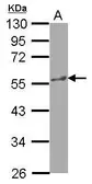 Anti-KATNA1 antibody [N1N3] used in Western Blot (WB). GTX119549