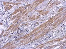 Anti-CRTAC1 antibody used in IHC (Paraffin sections) (IHC-P). GTX119558