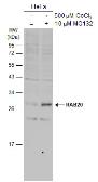 Anti-RAB20 antibody [N1C3] used in Western Blot (WB). GTX119559