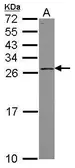 Anti-PSF3 antibody [N1C3] used in Western Blot (WB). GTX119563