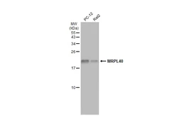Anti-MRPL40 antibody used in Western Blot (WB). GTX119564