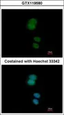 Anti-ZNF584 antibody [N3C3] used in Immunocytochemistry/ Immunofluorescence (ICC/IF). GTX119580