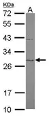 Anti-MTIF3 antibody [N1C2] used in Western Blot (WB). GTX119582